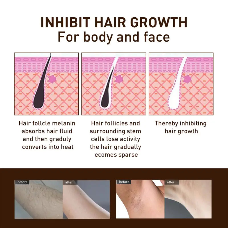 Gentle Hair Removal Spray for Whole Body - 30ml